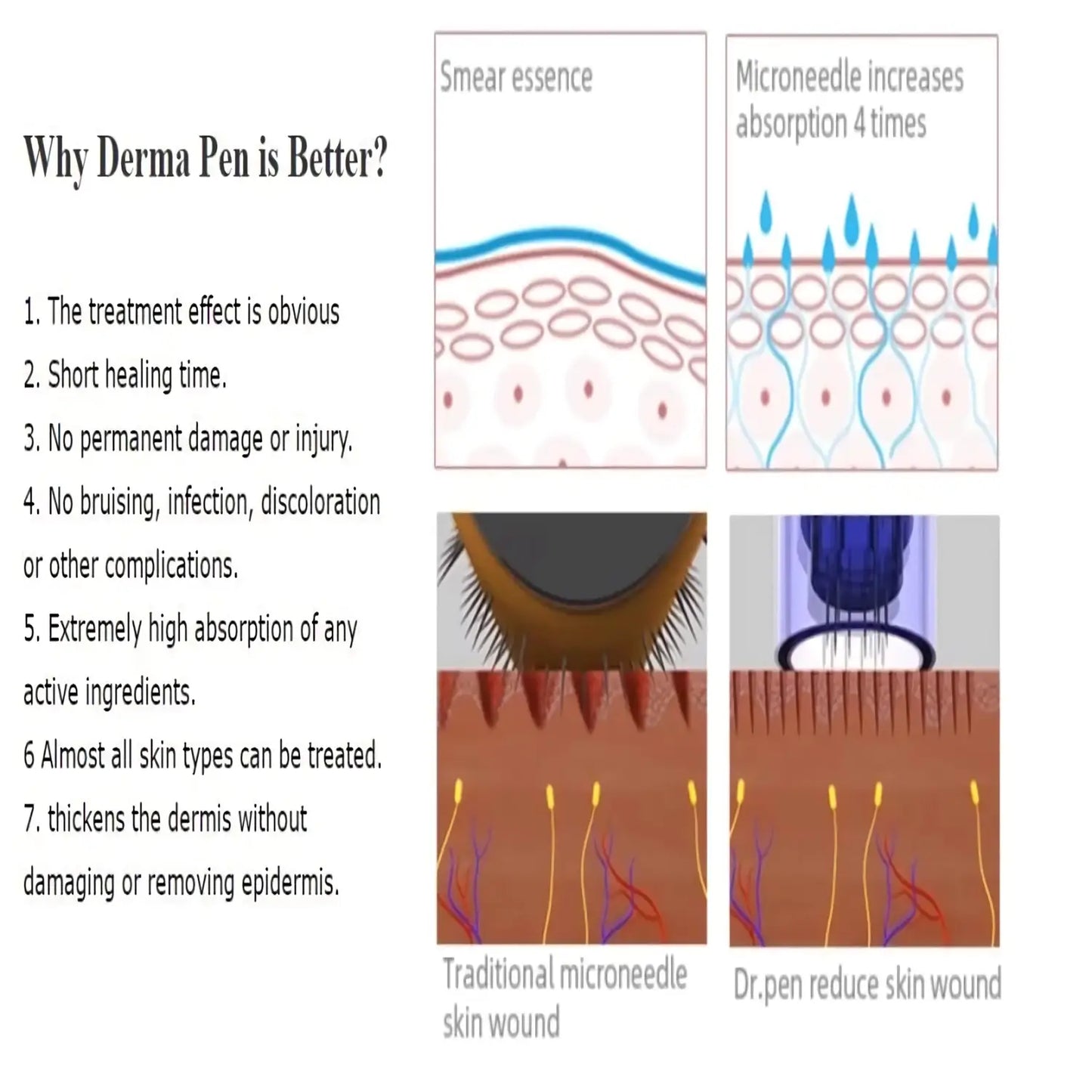 Dr. Pen A1 Microneedling Pen